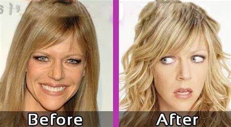 kaitlin olson ass|Kaitlin Olsons Plastic Surgery